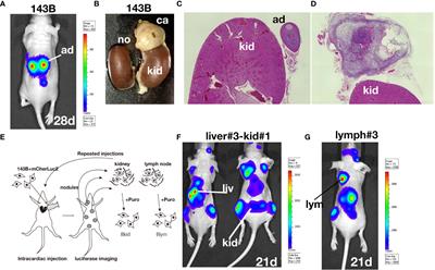 Pigment Epithelium Derived Factor Is Involved in the Late Phase of Osteosarcoma Metastasis by Increasing Extravasation and Cell-Cell Adhesion